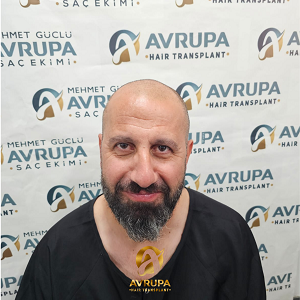 before-sapphire-hair-transplant-Turkey-4700-grafts-ClinicAdvisor.png