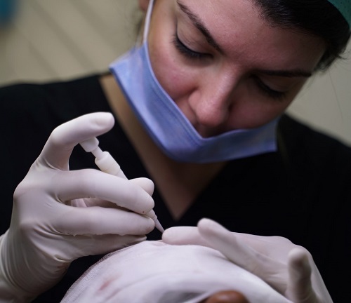 dhi-hair-transplant-Turkey-ClinicAdvisor.jpg