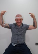 Hair transplant in Turkey - May 2024 (7).jpg
